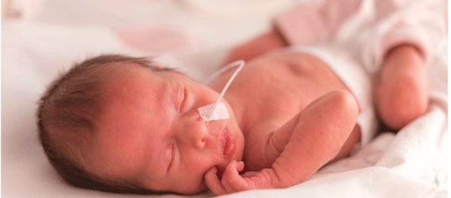 Ein Frühgeborenes Baby liegt auf dem Bett mit einem Schlauch in der Nase